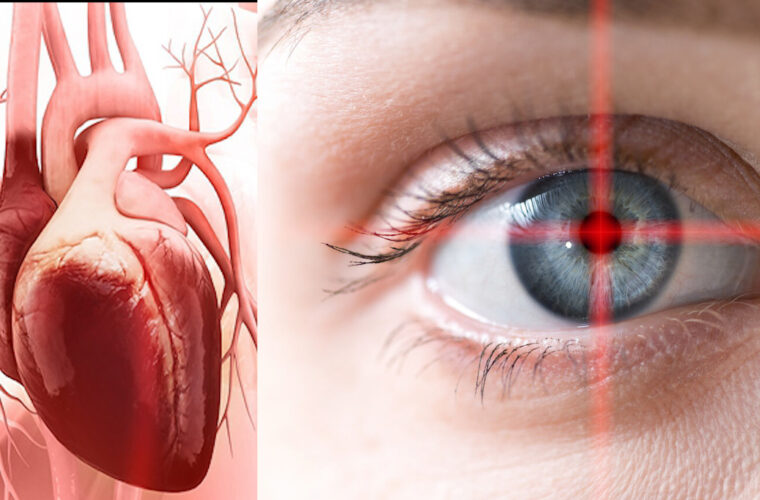 تشخیص بیماری‌ های قلبی از طریق چشم